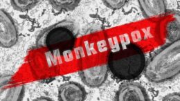 Monkeypox virus header